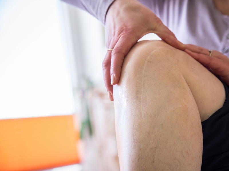 DPA Vorschau Bild für Artikel: Verletzung, Unfall und Co. / Was hilft, wenn mich das Aussehen einer Narbe belastet?