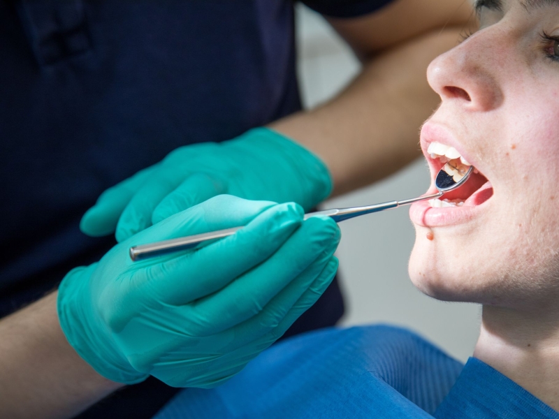 DPA Vorschau Bild für Artikel: Parodontitis / Zahnfleischbluten? Früh handeln schützt den ganzen Körper  