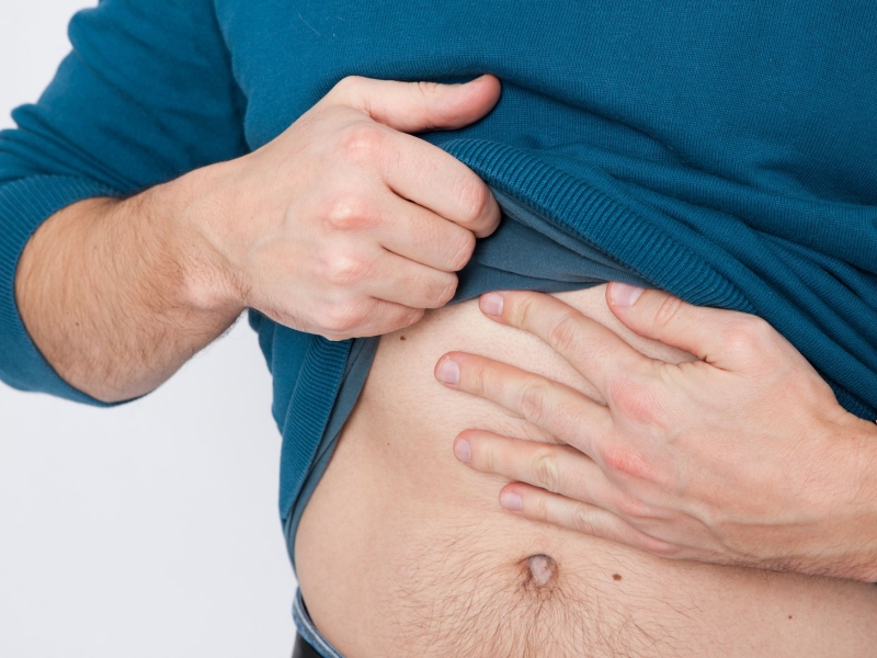 DPA Vorschau Bild für Artikel: Männer eher betroffen / Woher kommen die ganzen Fusseln in meinem Bauchnabel?  